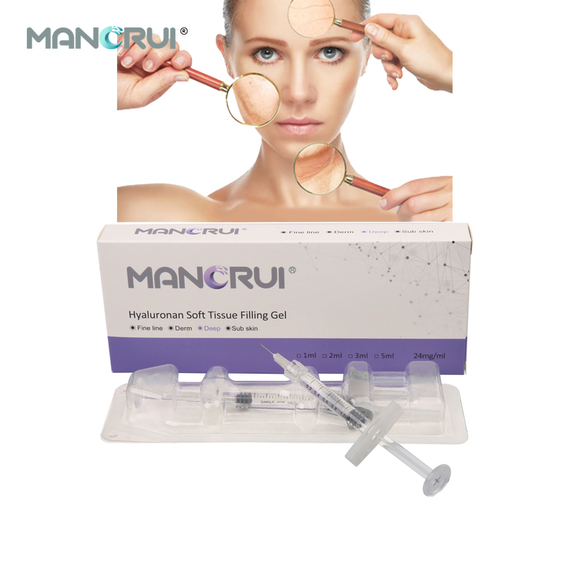 Deep 1ml Cross Linked Hyaluronic Acid Filler for  Wrinkle Removal – Nasolabial, Marionette, Forehead Lines