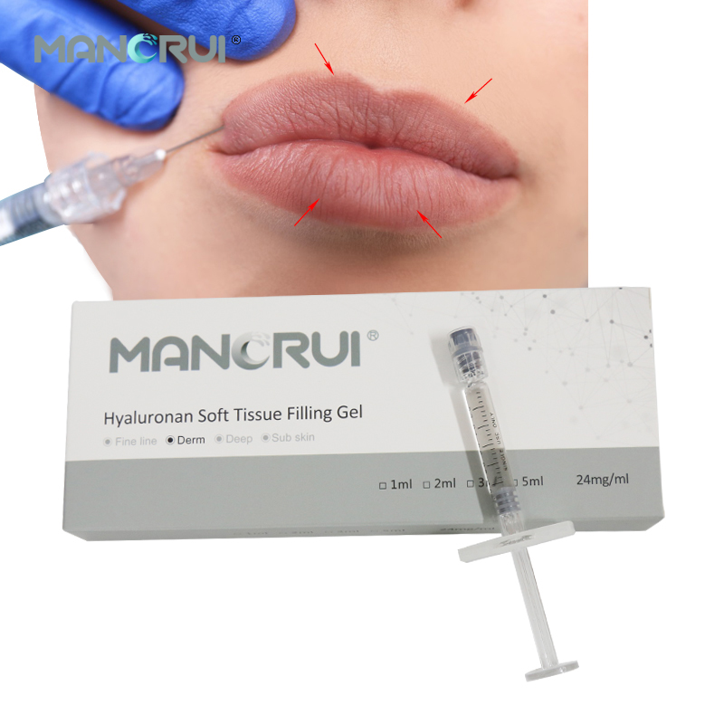 Derm 1ml Cross Linked Hyaluronic Acid Lip Filler