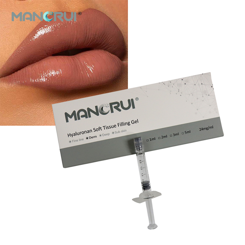 Cross Linked Hyaluronic Acid Injection Derm 2ml Lip Filler — Natural Lip Plumping, Marionette Line & Frown Line Correction, Mid-Depth Smile Line Treatment