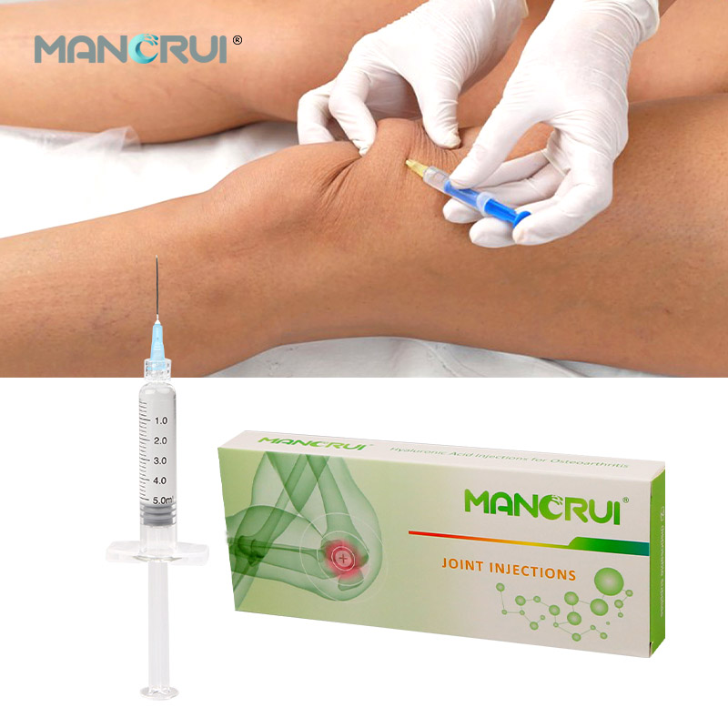 Hot sale Non cross linked hyaluronic acid gel knee joint 5ml（Certified by CE and FDA.）
